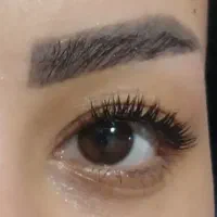 کاشت مژه هیدن