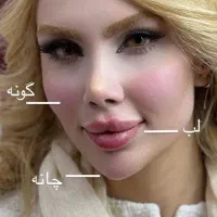 ژل و بوتاکس