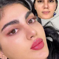لیزرموهای زائد،ژل لب فول فیس زاویه مزوبوتاکس هایفو|خدمات آرایشگری و زیبایی|مشهد, آزادشهر|دیوار