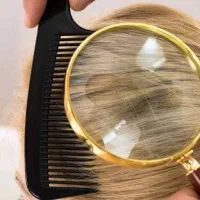 درمان شپش ورشک