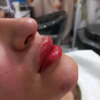 مدل شیدلب رفع تیرگی لب تضمینی..