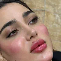 ژل و بوتاکس اف ب مناسبت ربیع الول