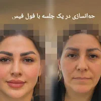 جشنواره تخفیفات کلینیک پوست همراه با هدیه|خدمات آرایشگری و زیبایی|مشهد, کوه سنگی|دیوار