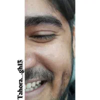 مدل ژل بوتاکس و پیرسینگ|خدمات آرایشگری و زیبایی|فولادشهر, مسکن مهر فولادشهر|دیوار