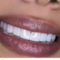 منشی خانم جهت دندانپزشکی