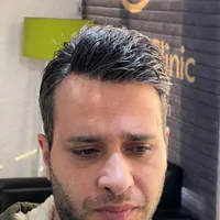 پروتز مو ویژه افراد سخت پسند|خدمات آرایشگری و زیبایی|تهران, حکمت|دیوار