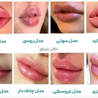 آف چربی بوتاکس ساکشن غبغب ژل مزو PRP، پزشک مجرب