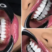 کاشت دندان 12 ( کشیدن رایگان)|خدمات زیبایی و سلامت|کرمانشاه, |دیوار