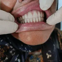 دندانسازی . دندان مصنوعی|خدمات آرایشگری و زیبایی|شیراز, سینما سعدی|دیوار