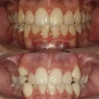 جشنواره دندانپزشکی (تمامی خدمات)|خدمات آرایشگری و زیبایی|اصفهان, لنبان|دیوار