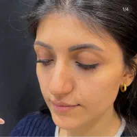 جشنواره یلدایی ژل / بوتاکس / جوانساز صورت(در مطب)|خدمات آرایشگری و زیبایی|شاهین‌شهر, فردوسی|دیوار