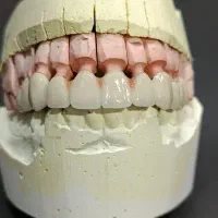 نیاز به پرسلن گذار دندانسازی  (پودر گذار )