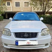 هیوندای ورنا 84 دنده ای