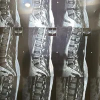 خدا حافظی کن با دیسک کمر و گردن