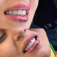 جشنواره کامپوزیت بیلیچینگ