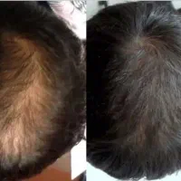 مراقبت پوست و مو|آرایشی، بهداشتی، درمانی|شیراز, طلاب|دیوار