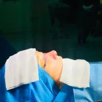 جراحی بینی بدون تامپون در رشت ۴۰ میلیون(عمل بینی)