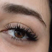 کاشت مژه