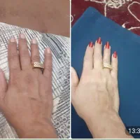 ک ر م vip سفیدکننده ضدلک