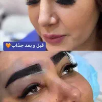 کاشت مو/ابرو /ریش|خدمات آرایشگری و زیبایی|شیراز, قدوسی غربی|دیوار