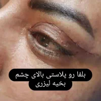 جراحی درمطب توسط پزشک جراح درخرم اباد|خدمات آرایشگری و زیبایی|دورود, |دیوار