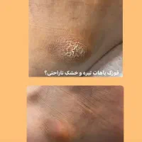 خدمات تخصصی پدیکور و ماساژ