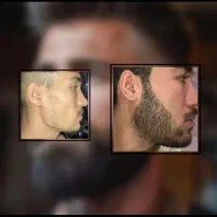 فوم تخصصی ماینو تضمینی