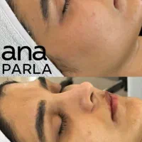 لیفت و جوانسازی پلک بدون جراحی با تخفیف ۵۰ درصد|خدمات آرایشگری و زیبایی|اصفهان, مرداویج|دیوار