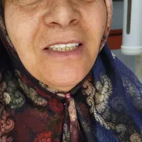 جشنواره دندان مصنوعی خارجی ژله ای با بیمه وضمانت|خدمات آرایشگری و زیبایی|کرج, مصباح|دیوار