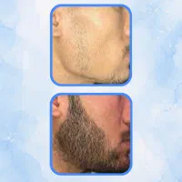 چهل روزه