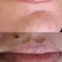تزریق ژل وبوتاکس آموزش ژل وبوتاکس آنزیم فیلربادی|خدمات آرایشگری و زیبایی|کرمانشاه, |دیوار