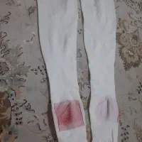 جوراب امبولی|آرایشی، بهداشتی، درمانی|تهران, شهرک امیرالمومنین|دیوار