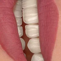 خدمات دندانپزشکی