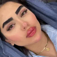 جشنواره طلایی  ژل،بوتاکس،انواع لیفت صورت