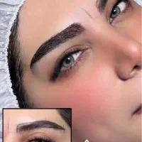 کاشت ابرو میکروکاشت
