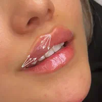 کانتورینگ لیفت فیلر بوتاکس مزو|خدمات آرایشگری و زیبایی|اصفهان, سپاهان‌شهر|دیوار