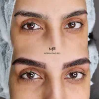 خدمات شیدینگ لب میکروبلیدینگ