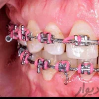 دندانپزشکی با بیمه تکمیلی و آزاد / بدون پیش|خدمات آرایشگری و زیبایی|بهبهان, |دیوار