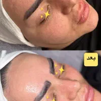 فیشیال تخصصی پوست