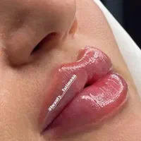 تزریق ژل لب و بوتاکس|خدمات آرایشگری و زیبایی|شیراز, شهرک مهدی‌آباد|دیوار