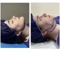 جشنواره جراحی زیبایی