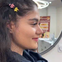 10 میلیون تخفیف عمل جراحی بینی بدون تامپون،لیفت