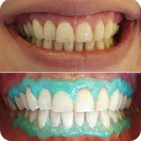 خدمات دندانپزشکی با قیمت مناسب|خدمات آرایشگری و زیبایی|تهران, مینابی|دیوار