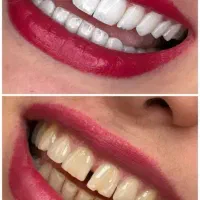 کوهدشت|خدمات آرایشگری و زیبایی|کوهدشت, |دیوار