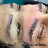 پاک کردن و ریموو تتو ابرو چشم لب ۱۰۰٪ تضمینی|خدمات آرایشگری و زیبایی|یاسوج, |دیوار