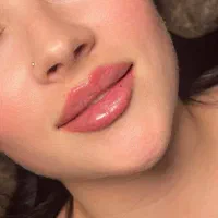 فیلر بوتاکس ژل مزو اقساط با ۵۰ % تخفیف توسط دکتر