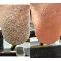 پدیکورپا(فقط300.350)