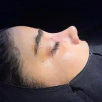 عمل های زیبایی توسط پزشک متخصص با مناسبترین قیمت|خدمات آرایشگری و زیبایی|اهواز, کیانپارس |دیوار