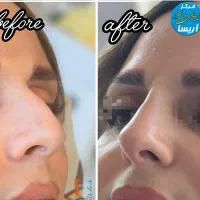 تخفیف ویژه خدمات پوست و مو به مناسبت روز  پزشک|خدمات آرایشگری و زیبایی|کرمانشاه, |دیوار