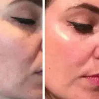 کیلینیک زیبایی (پوست ،مو ،لیزر )|خدمات آرایشگری و زیبایی|اسلام‌شهر, شهرک واوان|دیوار